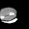 SPORK, NICO - 22.03.1976 - 02.08.2022 - CT obere Extremität - 17:56:57